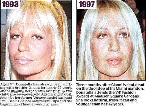 is donatella versace a man or woman|what happened to donatella versace.